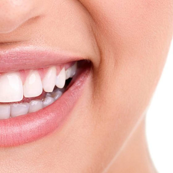 5 Tips For Improving The Results Of Your Orthodontic Treatment